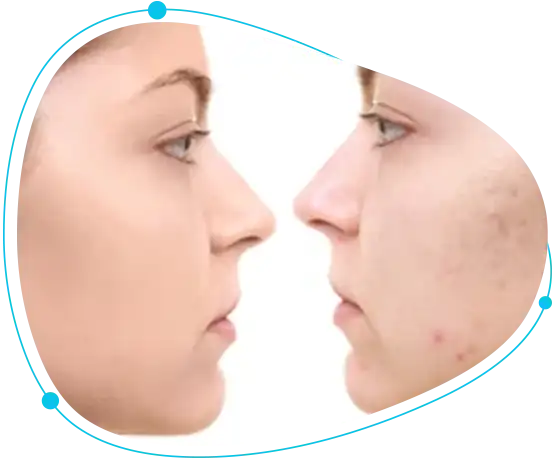 Advanced laser cosmetic treatment