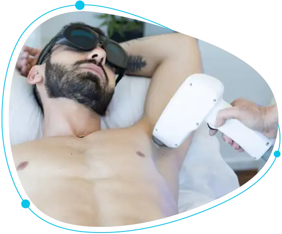 Advanced laser hair removal technology
