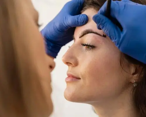 Browlift
