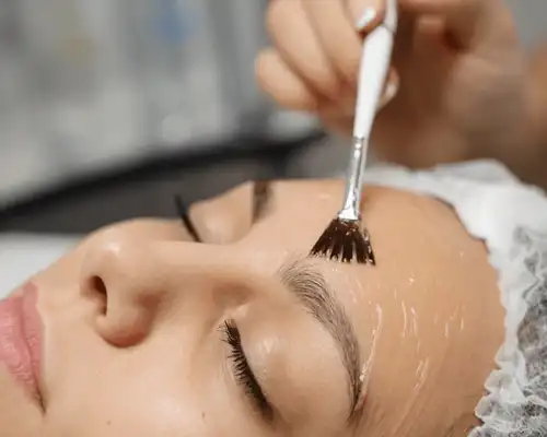 Customized Peels