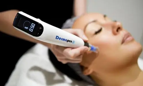 Dermapen 4 Microneedling Treatment