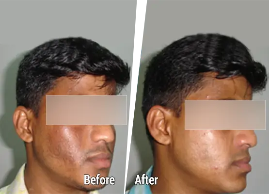 Diagnose melasma process
