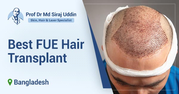 Best FUE Hair Transplant in Bangladesh | Dr. Siraj Uddin