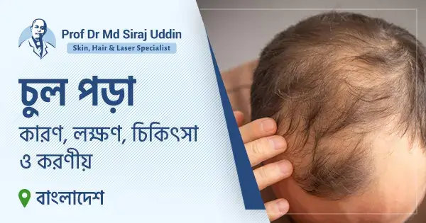 চুল পড়া: কারণ, লক্ষণ, চিকিৎসা ও করণীয়