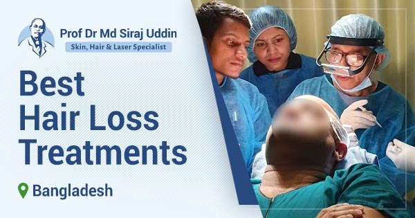 Best hair loss treatments in Bangladesh | Expert guide