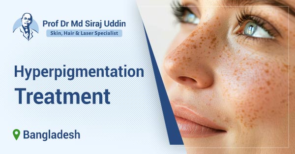 Hyperpigmentation treatment in Bangladesh