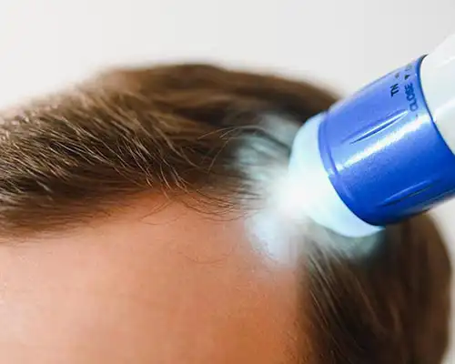 Laser hair growth therapy