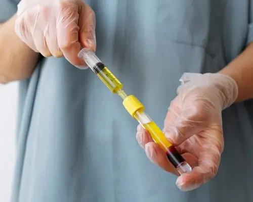 Plasma preparation