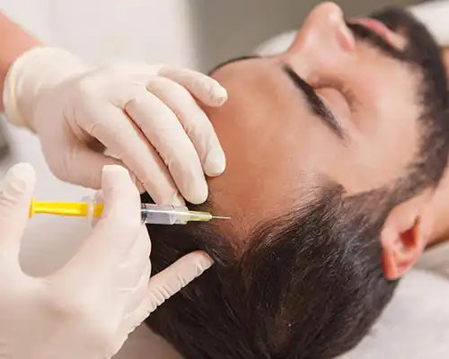 PRP hair treatment