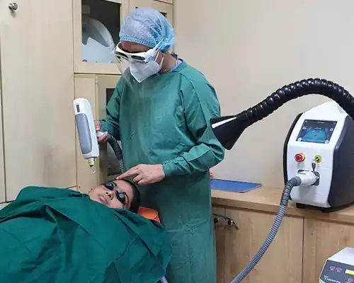 Q-Switch Laser