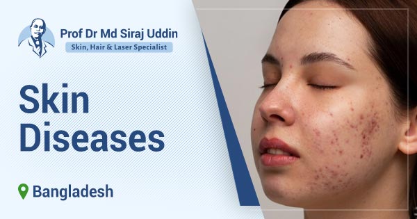 Best Skin Disease Specialist (dermatologist) in Bangladesh