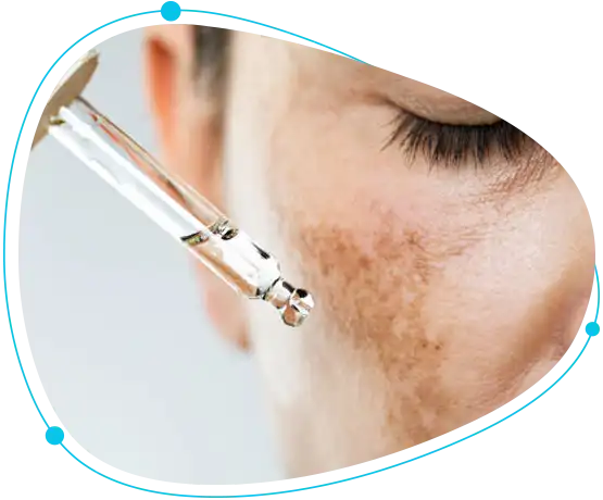 Skin Diseases specialist in Bangladesh
