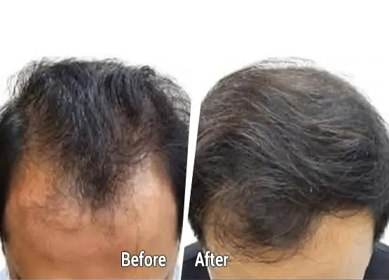 Specialist in advanced hair restoration