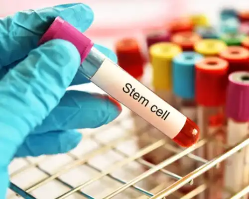 Stem Cell Therapy
