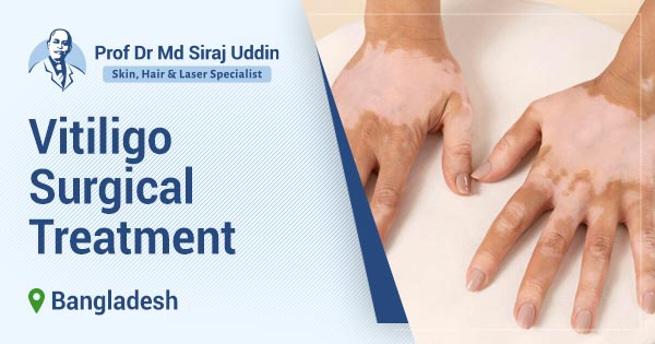 Vitiligo Surgical Treatment in Dhaka Bangladesh